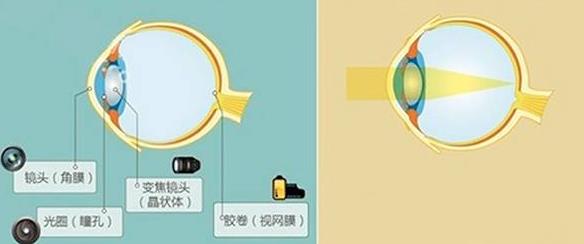 怎么佩戴老花鏡？驗光 品牌 質(zhì)量 保養(yǎng)一個都不能少